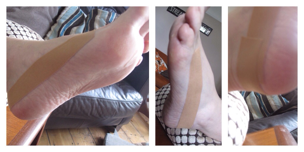 Foot Taping for Blister Prevention