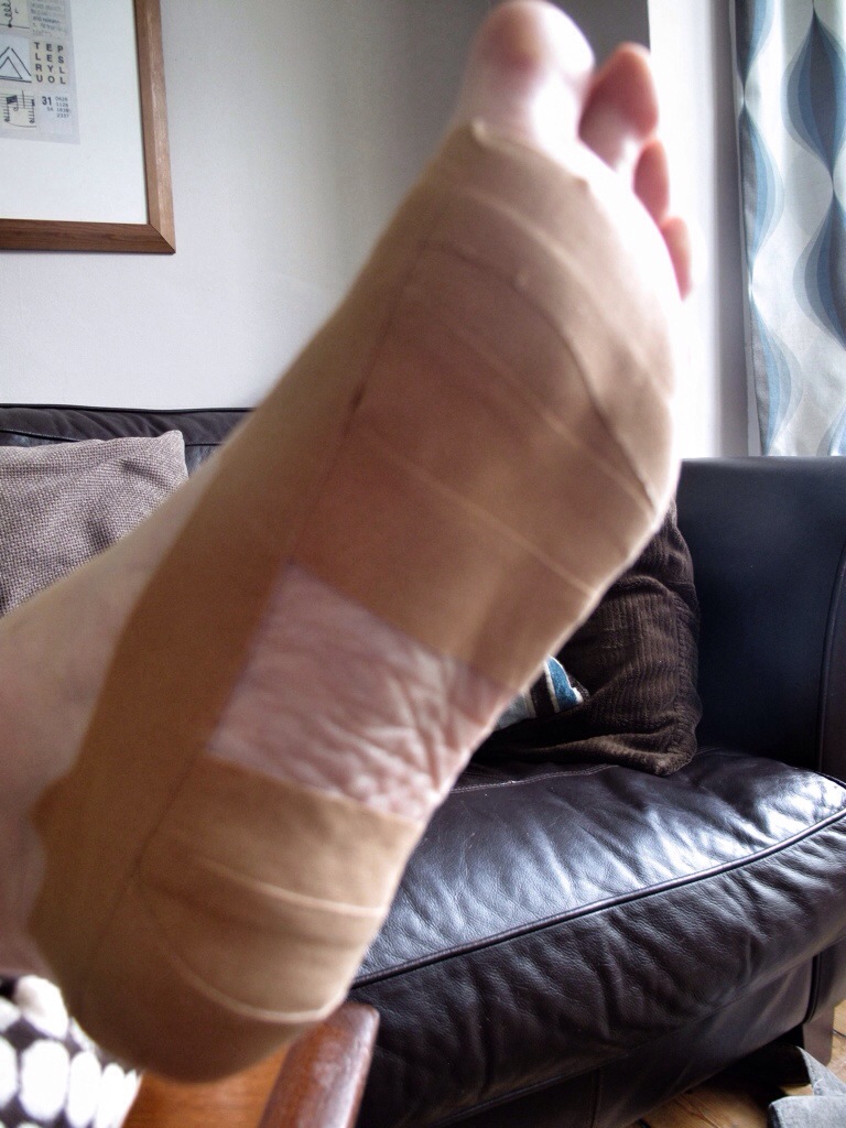 Foot Taping for Long Distance Walks